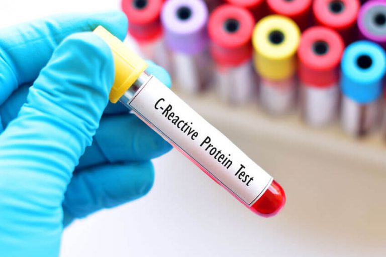 What Is Blood Test Crp at Pamela Guerrero blog